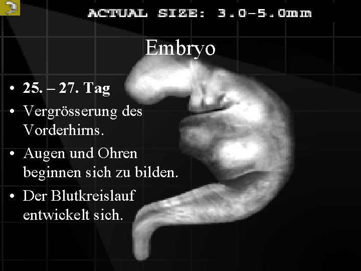 Embryo • 25. – 27. Tag • Vergrösserung des Vorderhirns. • Augen und Ohren