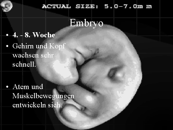 Embryo • 4. - 8. Woche • Gehirn und Kopf wachsen sehr schnell. •