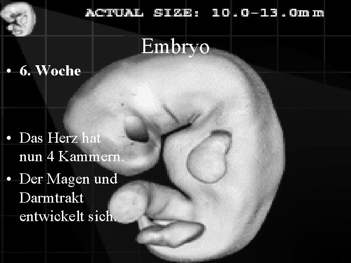 Embryo • 6. Woche • Das Herz hat nun 4 Kammern. • Der Magen