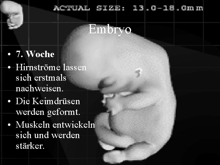 Embryo • 7. Woche • Hirnströme lassen sich erstmals nachweisen. • Die Keimdrüsen werden