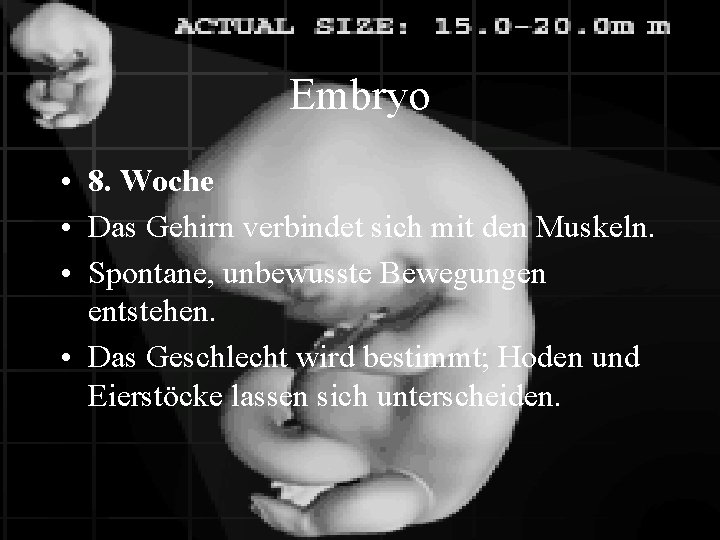 Embryo • 8. Woche • Das Gehirn verbindet sich mit den Muskeln. • Spontane,