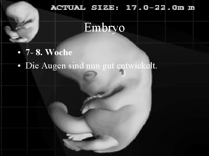 Embryo • 7 - 8. Woche • Die Augen sind nun gut entwickelt. 