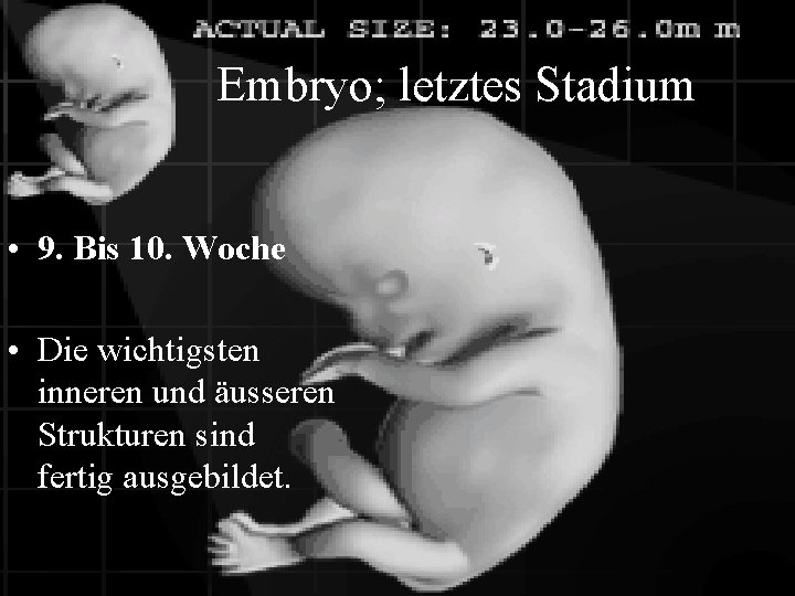 Embryo; letztes Stadium • 9. Bis 10. Woche • Die wichtigsten inneren und äusseren