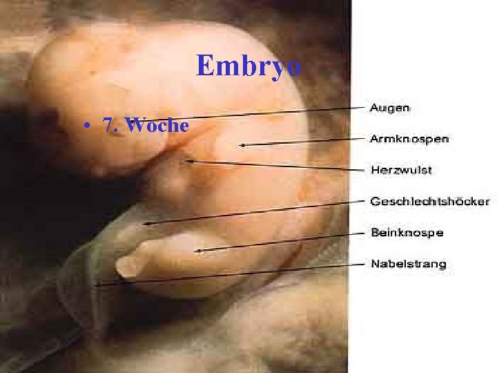 Embryo • 7. Woche 