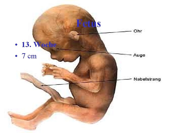 Fetus • 13. Woche • 7 cm 