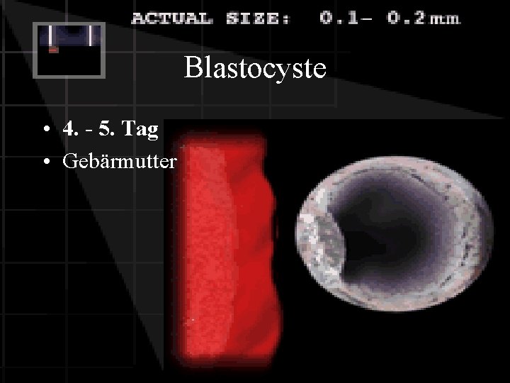 Blastocyste • 4. - 5. Tag • Gebärmutter 