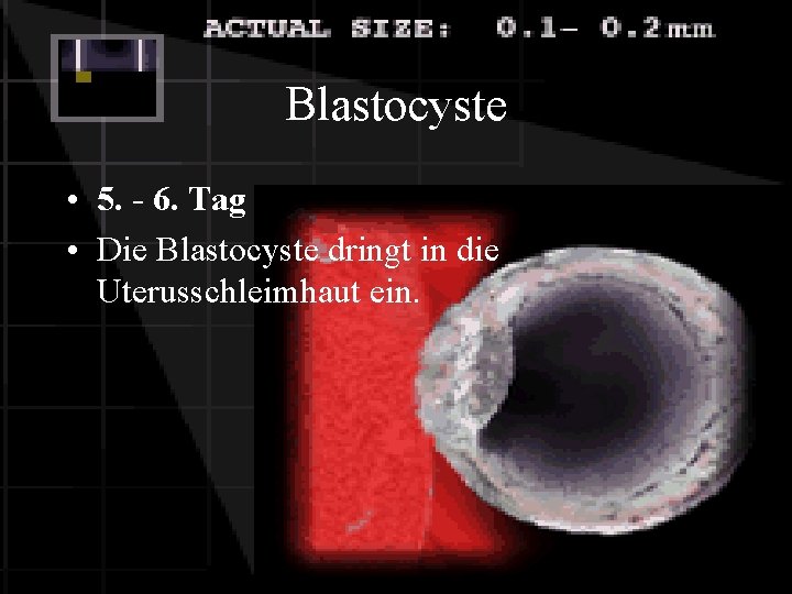 Blastocyste • 5. - 6. Tag • Die Blastocyste dringt in die Uterusschleimhaut ein.