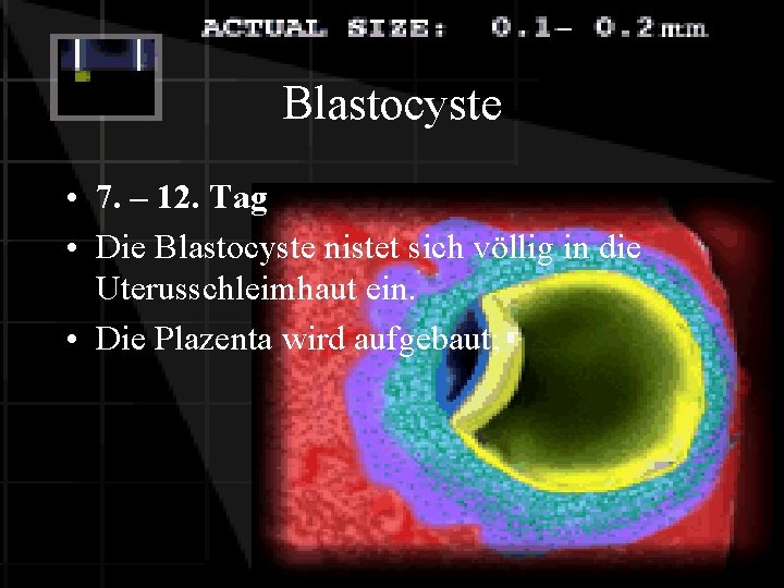 Blastocyste • 7. – 12. Tag • Die Blastocyste nistet sich völlig in die