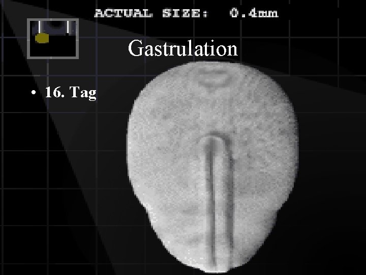 Gastrulation • 16. Tag 