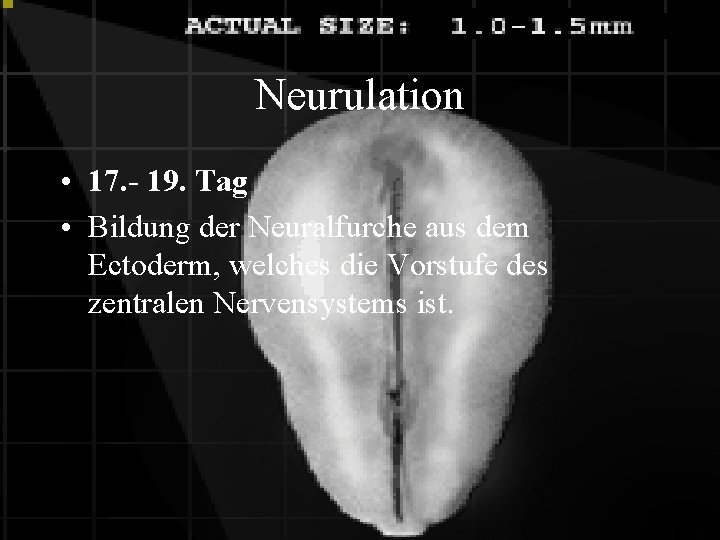 Neurulation • 17. - 19. Tag • Bildung der Neuralfurche aus dem Ectoderm, welches