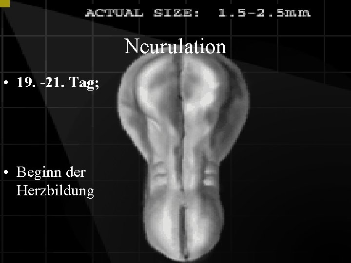 Neurulation • 19. -21. Tag; • Beginn der Herzbildung 