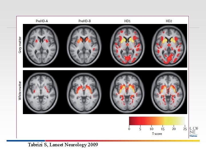 Tabrizi S, Lancet Neurology 2009 