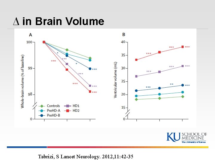 ∆ in Brain Volume Tabrizi, S Lancet Neurology. 2012, 11: 42 -35 