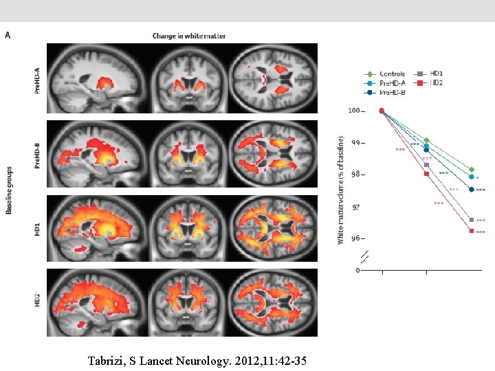 Tabrizi, S Lancet Neurology. 2012, 11: 42 -35 