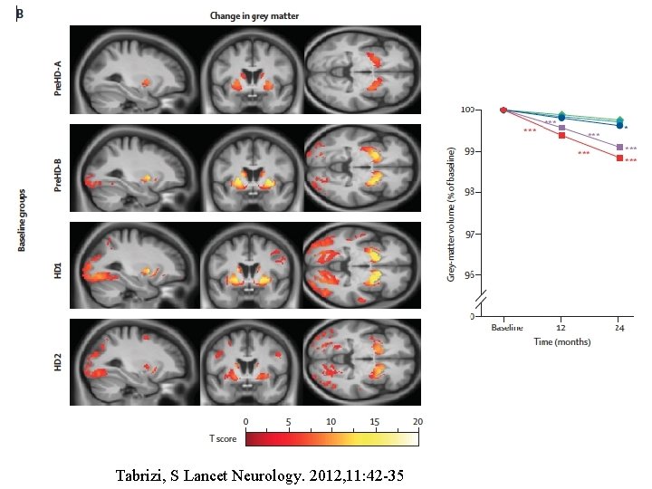 Tabrizi, S Lancet Neurology. 2012, 11: 42 -35 