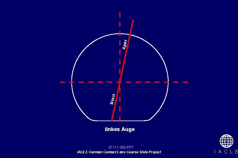 Apex Basis linkes Auge 97111 -39 S. PPT IACLE German Contact Lens Course Slide