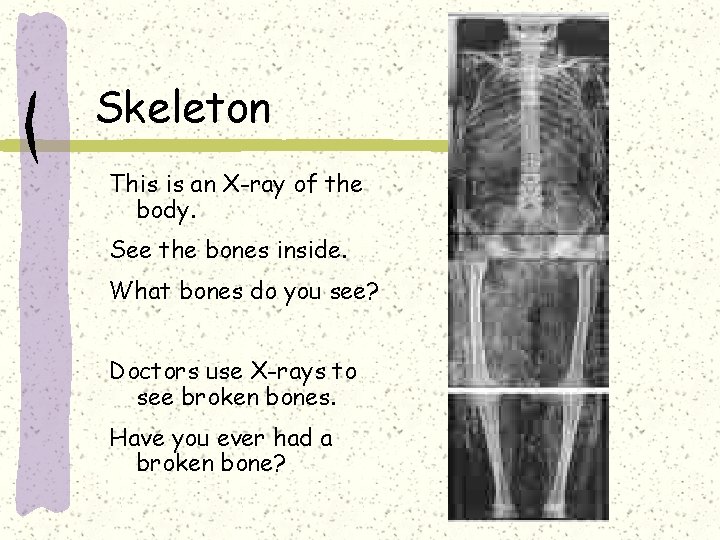 Skeleton This is an X-ray of the body. See the bones inside. What bones
