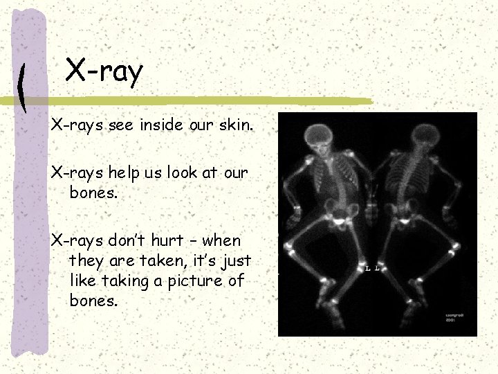 X-rays see inside our skin. X-rays help us look at our bones. X-rays don’t