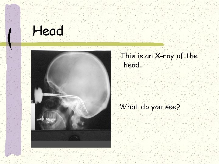 Head This is an X-ray of the head. What do you see? 