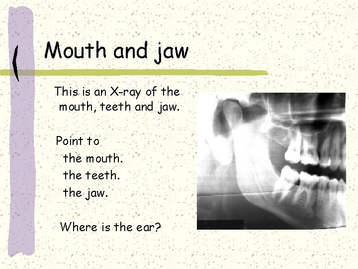 Mouth and jaw This is an X-ray of the mouth, teeth and jaw. Point