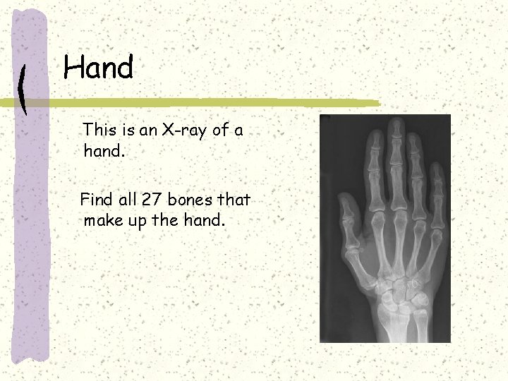 Hand This is an X-ray of a hand. Find all 27 bones that make