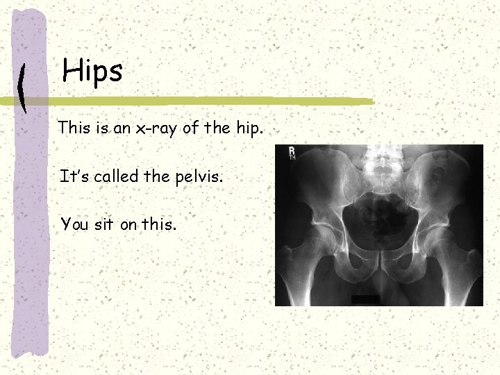 Hips This is an x-ray of the hip. It’s called the pelvis. You sit