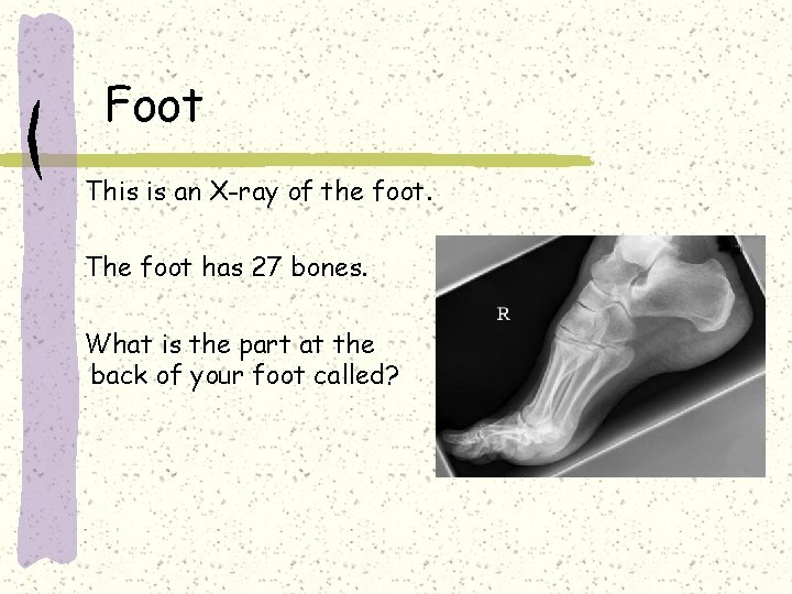 Foot This is an X-ray of the foot. The foot has 27 bones. What