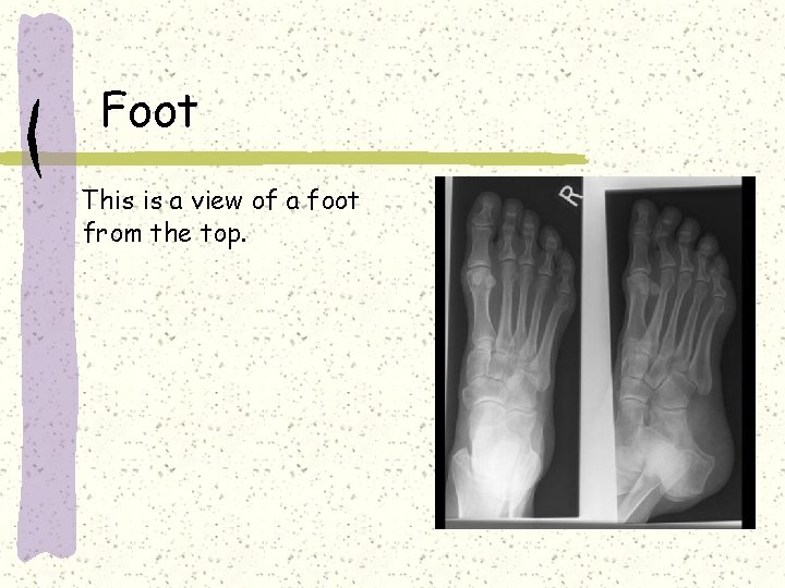 Foot This is a view of a foot from the top. 