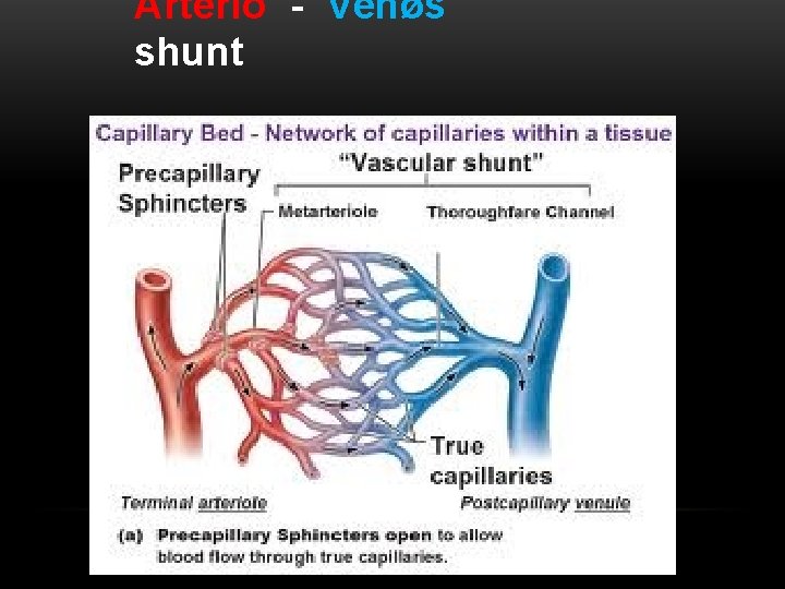 Arterio - Venøs shunt 