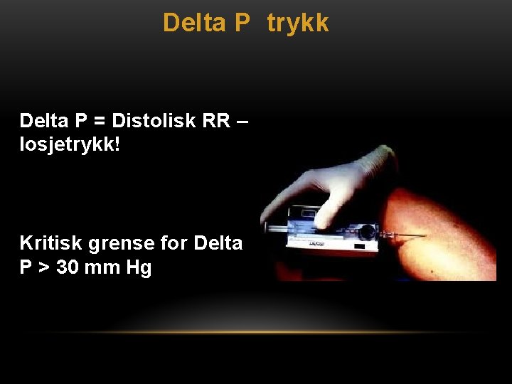 Delta P trykk Delta P = Distolisk RR – losjetrykk! Kritisk grense for Delta