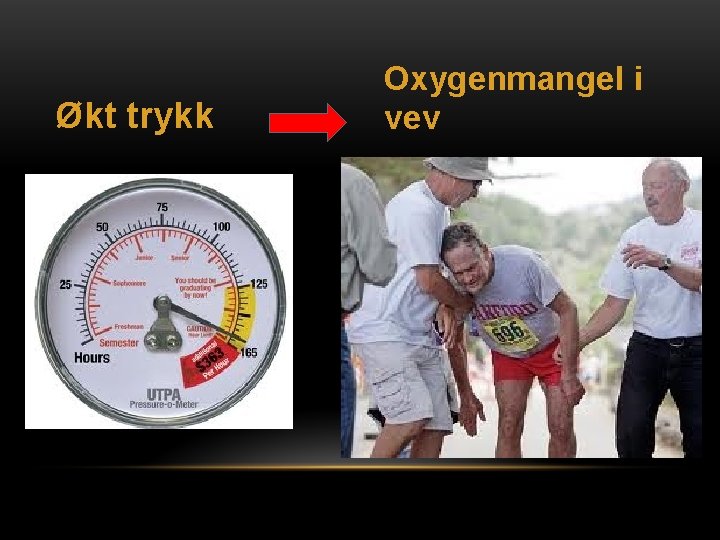 Økt trykk Oxygenmangel i vev 