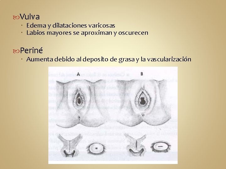  Vulva Edema y dilataciones varicosas Labios mayores se aproximan y oscurecen Periné Aumenta