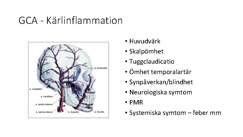 GCA - Kärlinflammation • Huvudvärk • Skalpömhet • Tuggclaudicatio • Ömhet temporalartär • Synpåverkan/blindhet