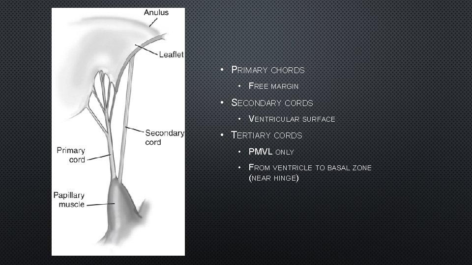  • PRIMARY CHORDS • FREE MARGIN • SECONDARY CORDS • VENTRICULAR SURFACE •