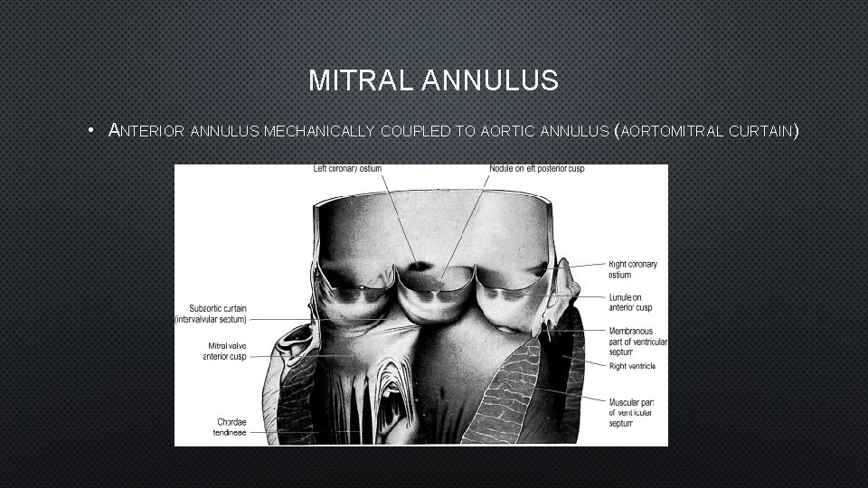 MITRAL ANNULUS • ANTERIOR ANNULUS MECHANICALLY COUPLED TO AORTIC ANNULUS (AORTOMITRAL CURTAIN) 