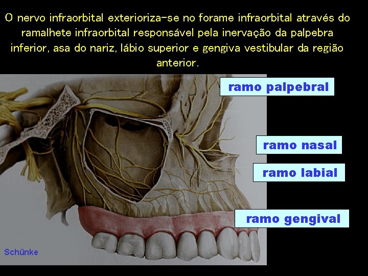 O nervo infraorbital exterioriza-se no forame infraorbital através do ramalhete infraorbital responsável pela inervação