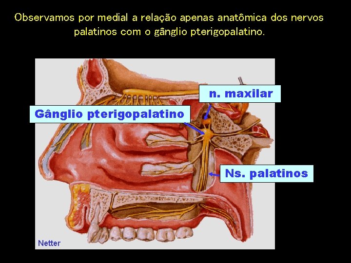 Observamos por medial a relação apenas anatômica dos nervos palatinos com o gânglio pterigopalatino.