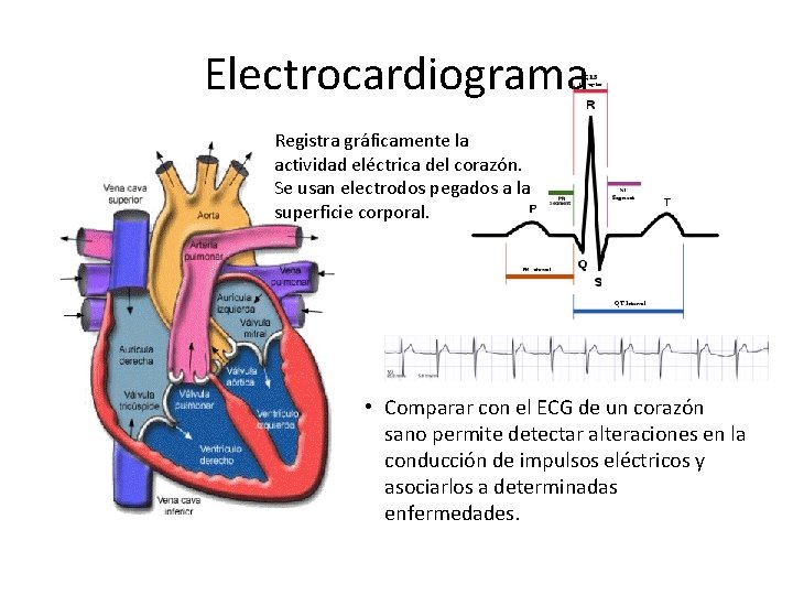 Electrocardiograma Registra gráficamente la actividad eléctrica del corazón. Se usan electrodos pegados a la