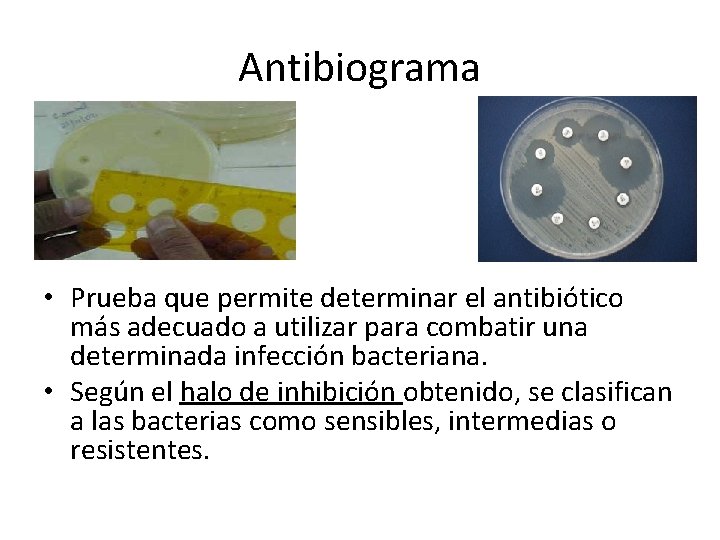 Antibiograma • Prueba que permite determinar el antibiótico más adecuado a utilizar para combatir