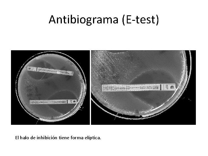 Antibiograma (E-test) El halo de inhibición tiene forma elíptica. 