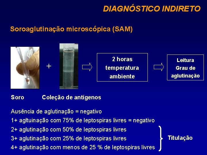 DIAGNÓSTICO INDIRETO Soroaglutinação microscópica (SAM) + Soro 2 horas temperatura ambiente Leitura Grau de