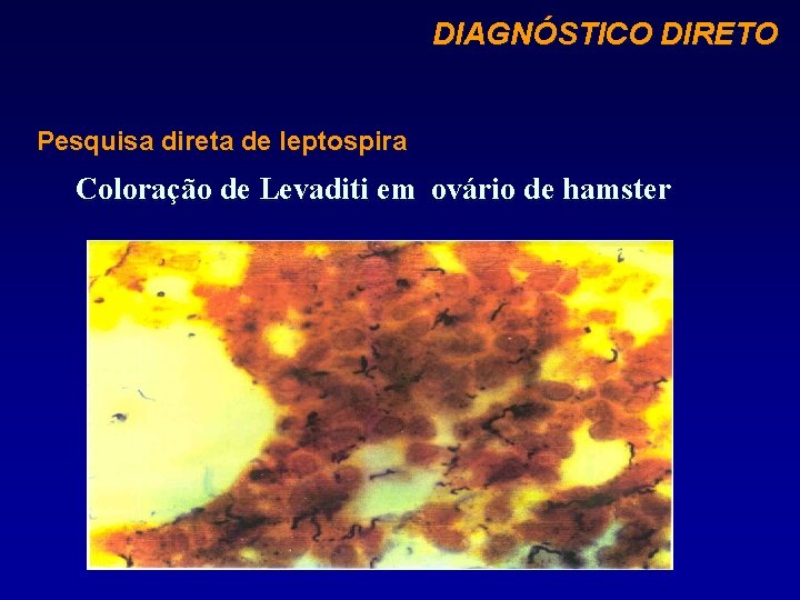 DIAGNÓSTICO DIRETO Pesquisa direta de leptospira Coloração de Levaditi em ovário de hamster 