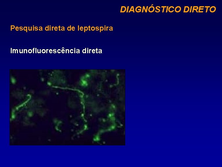 DIAGNÓSTICO DIRETO Pesquisa direta de leptospira Imunofluorescência direta 