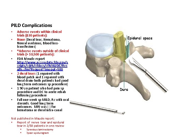 PILD Complications • • Adverse events within clinical trials (830 patients): None (Dural tear,