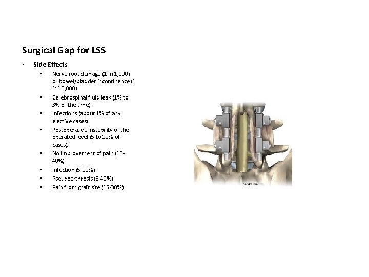 Surgical Gap for LSS • Side Effects • • Nerve root damage (1 in Surgical Gap for LSS • Side Effects • • Nerve root damage (1 in