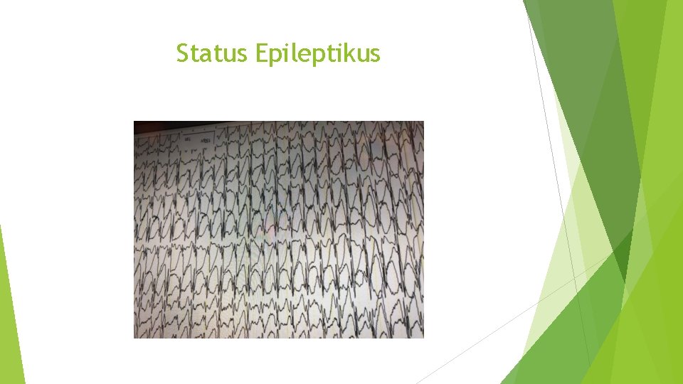 Status Epileptikus 