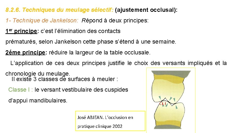 8. 2. 6. Techniques du meulage sélectif: (ajustement occlusal): 1 - Technique de Jankelson: