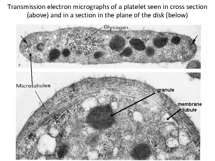 Transmission electron micrographs of a platelet seen in cross section (above) and in a