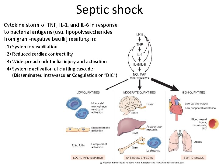 Septic shock Cytokine storm of TNF, IL-1, and IL-6 in response to bacterial antigens