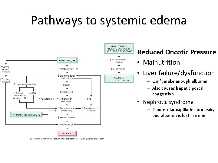 Pathways to systemic edema Reduced Oncotic Pressure • Malnutrition • Liver failure/dysfunction – Can’t